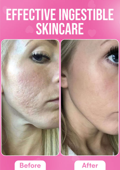 It Girl Skin – Skin Food