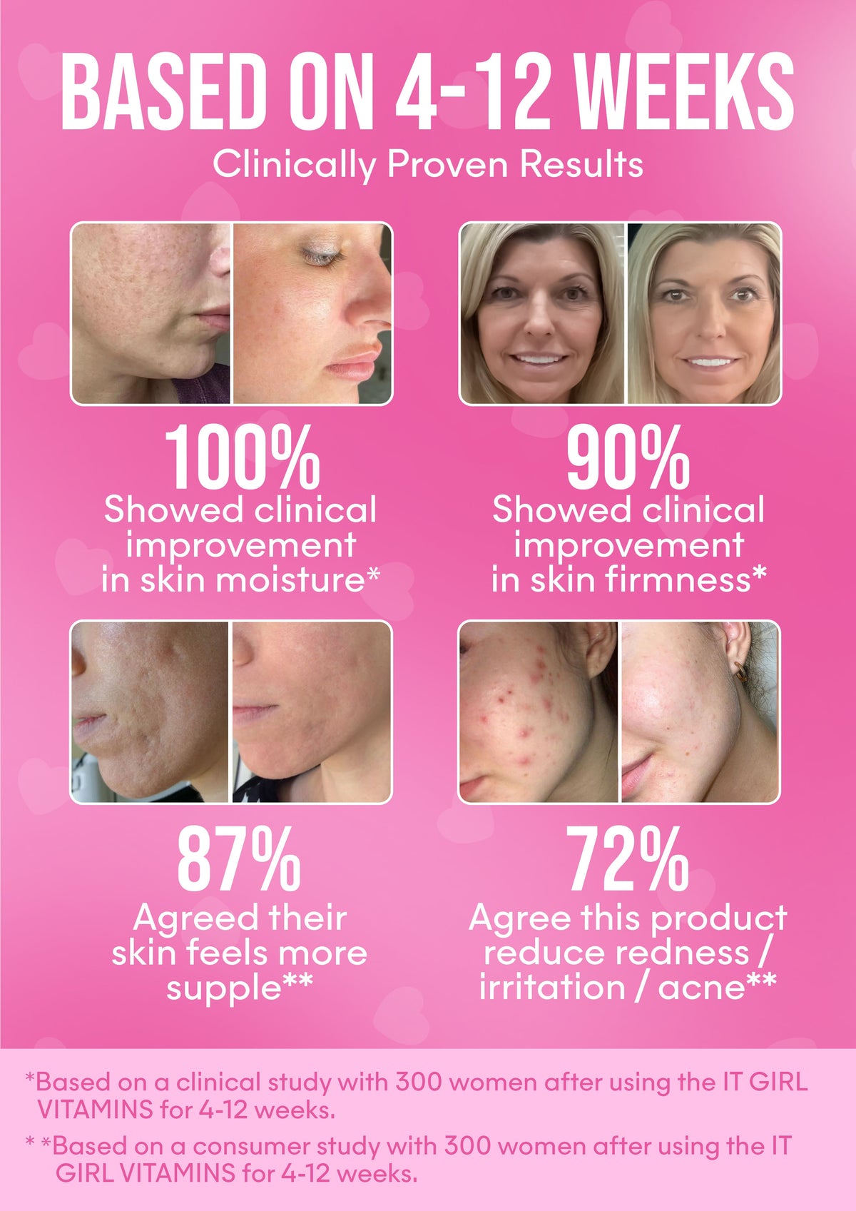 It Girl Skin – Skin Food